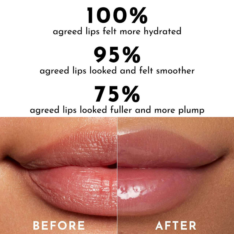 Before and after results of PHOFAY Hyaluronic Lip Gloss showcasing hydration, smoothness, and plumpness of lips.