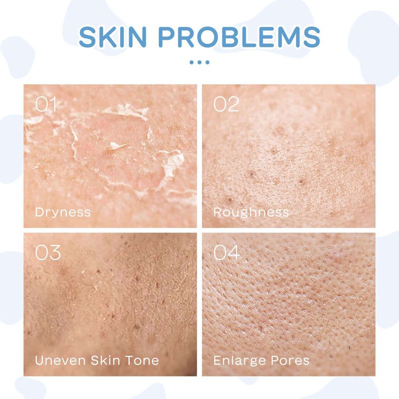 Image showing common skin problems: dryness, roughness, uneven skin tone, and enlarged pores.